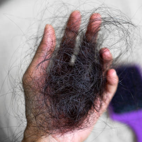 Penyebab Rambut Rontok