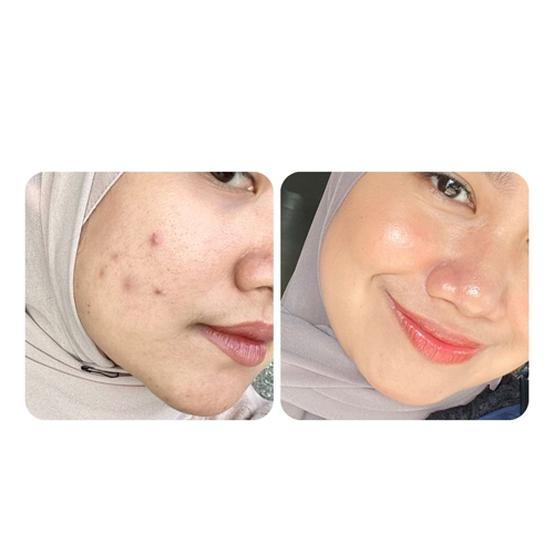 Rahasia Kulit Glowing Korea